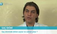 sac-ekiminde-ekilen-saclar-ne-zaman-cikar-izle-video