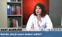 deride-alerji-nasil-tedavi-edilir