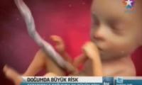 iki-dogumdan-biri-sezeryan-izle-video
